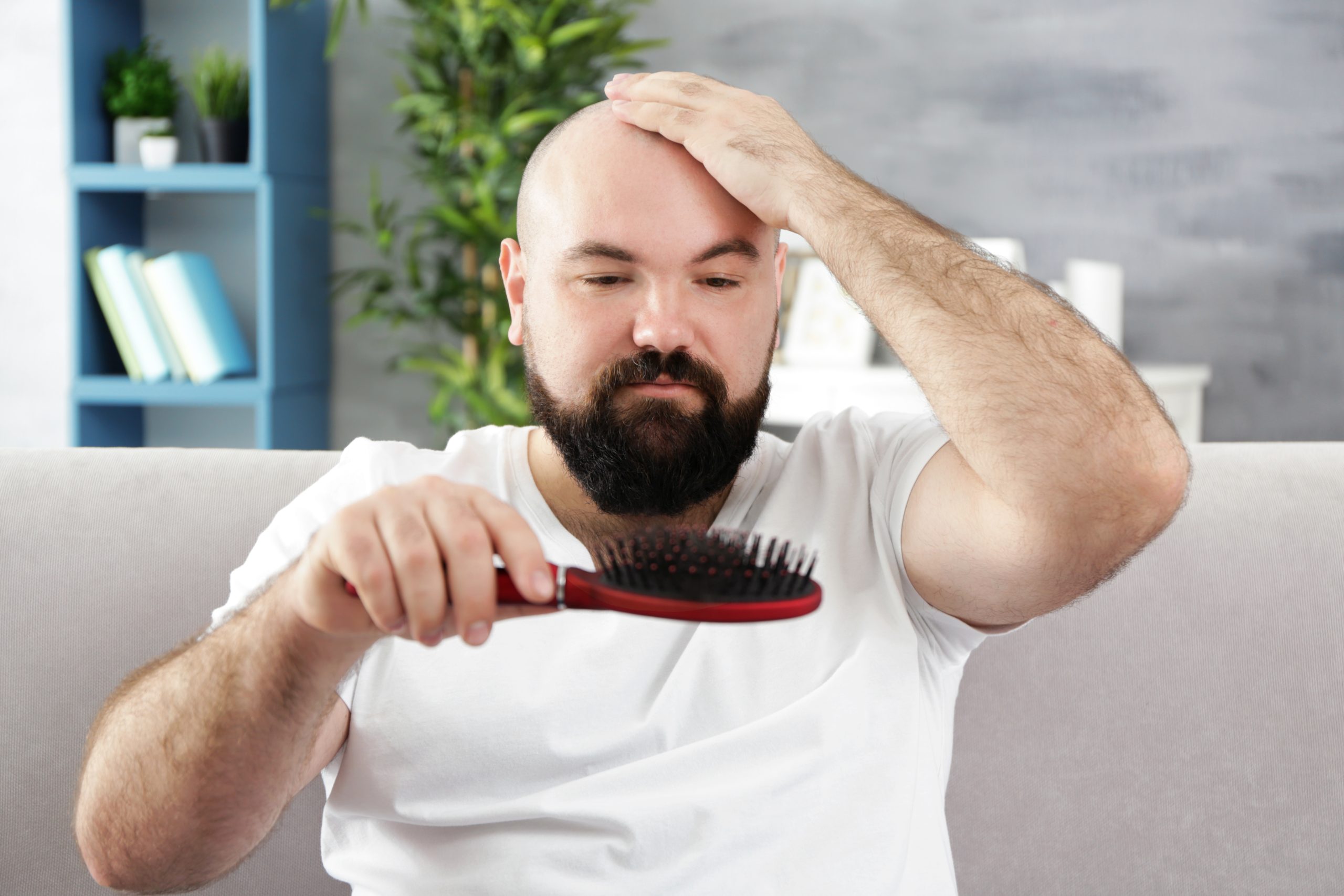 Testosterone serves as the main factor leading to male hair loss